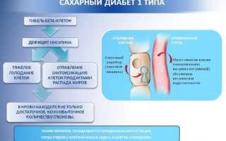 Сахарный диабет 1 типа: диета и лечение болезни по правилам