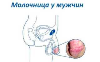 Список эффективных таблеток от молочницы для мужчин