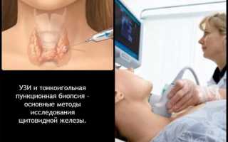 УЗИ желудка: что показывает, как делают, можно ли увидеть язву или рак желудка?