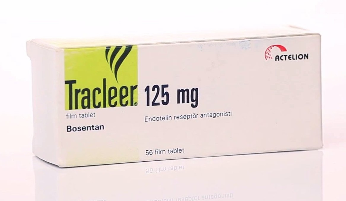 Легочная гипертензия симптомы и лечение при беременности