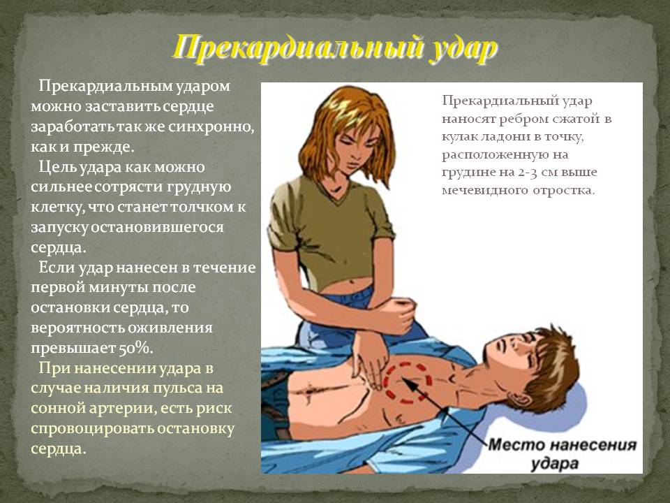 Синдром Морганьи-Адамса-Стокса